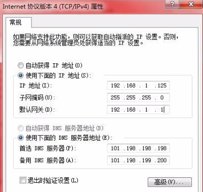 本地连接ip地址如何查看 本地连接ip地址如何查看